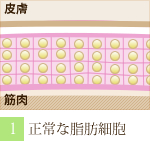 阪南市 エステサロン 痩身  正常な脂肪細胞。（ラジオ波 痩身トリートメントの流れ）