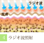 阪南市 エステサロン 痩身 ラジオ波照射で老廃物を排泄。（ラジオ波 痩身トリートメントの流れ）