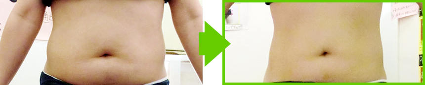 阪南市 エステサロン 痩身 ラジオ波トリートメントの劇的痩身効果！本気で痩せたいなら阪南市エステサロン「manomano(マノマノ）」へ