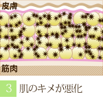 阪南市 エステサロン 美顔 小顔 老廃物でガチガチになった細胞。（ラジオ波 フェイシャルトリートメントの流れ）