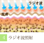 阪南市 エステサロン 美顔 小顔 ラジオ波照射で老廃物を排泄。（ラジオ波 フェイシャルトリートメントの流れ）